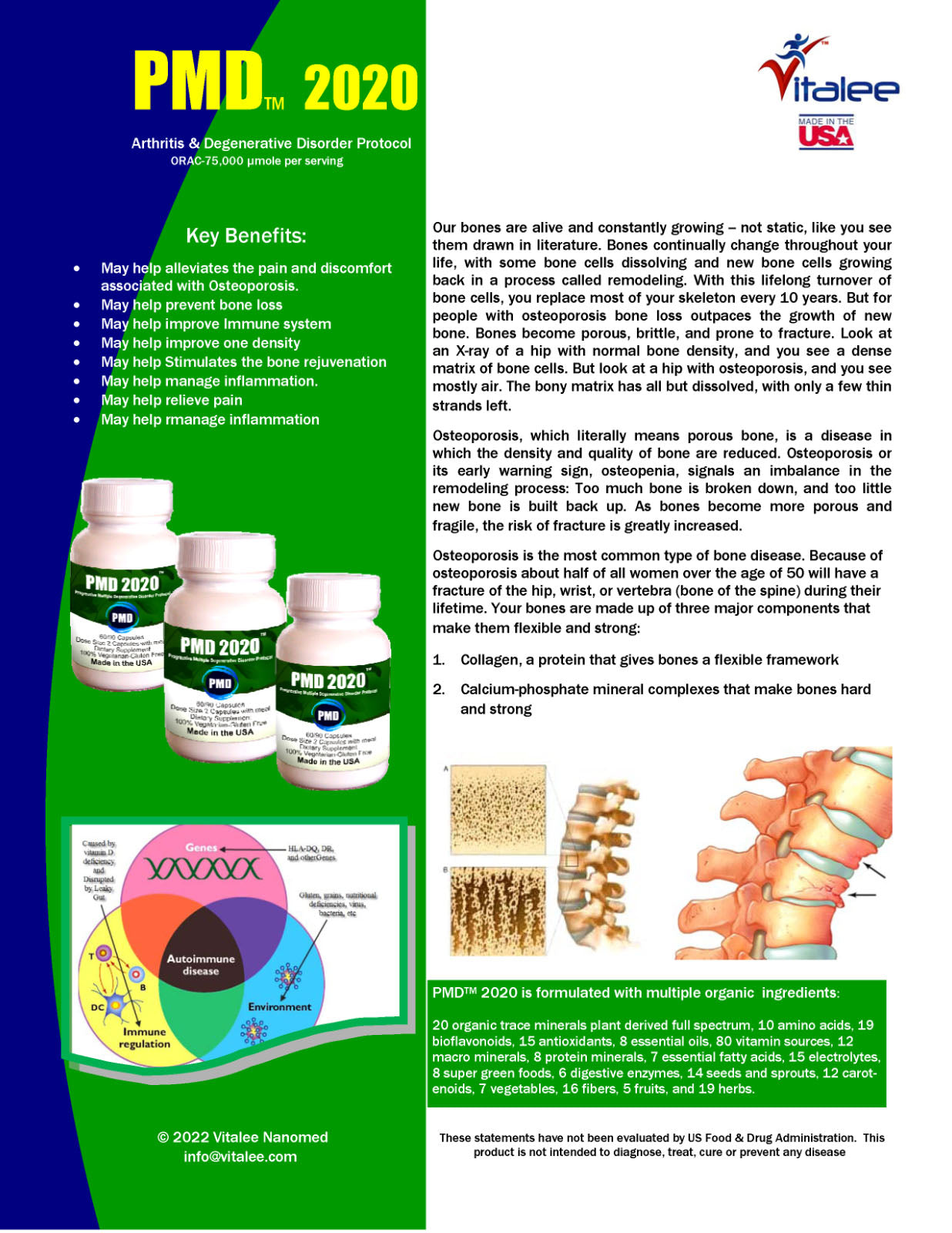 PMD Arthritis & Bone Degenerative Disorder