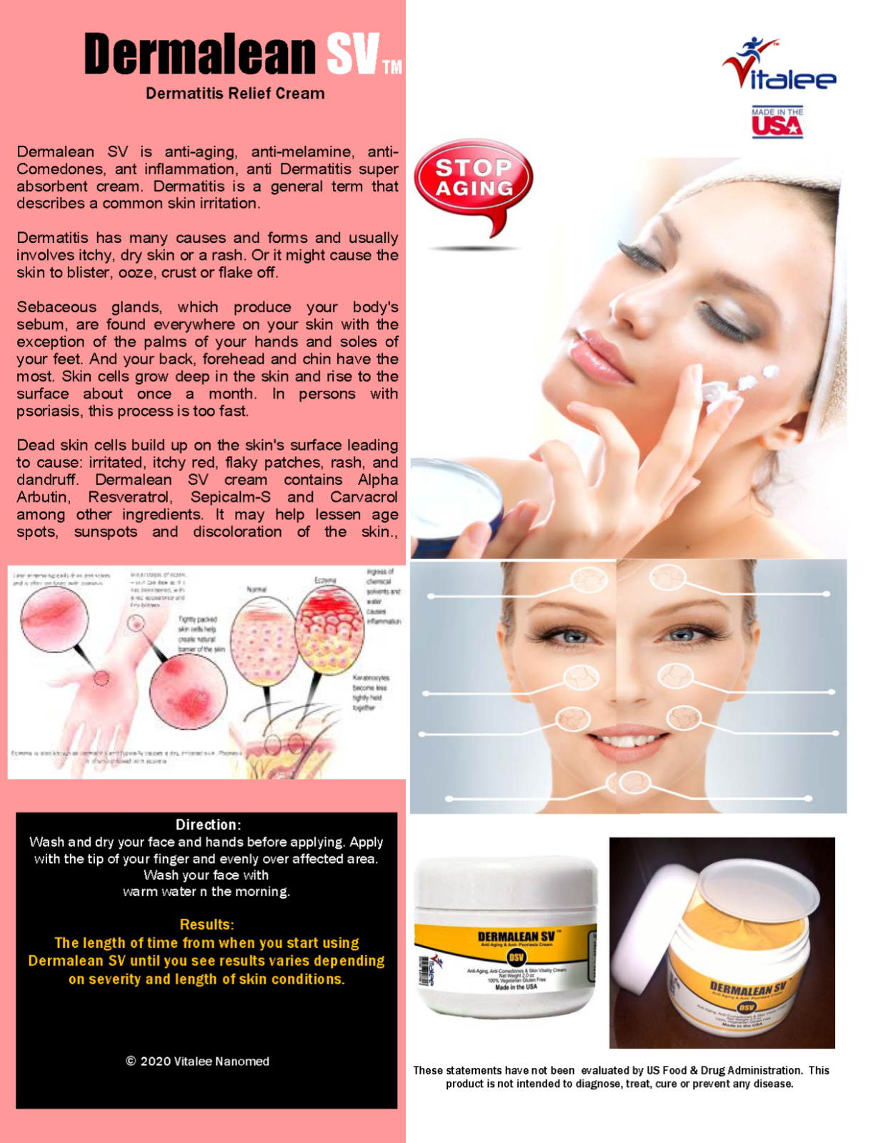 Dermalean SV Cream For Dermatitis Relief( 2 Oz Cream)