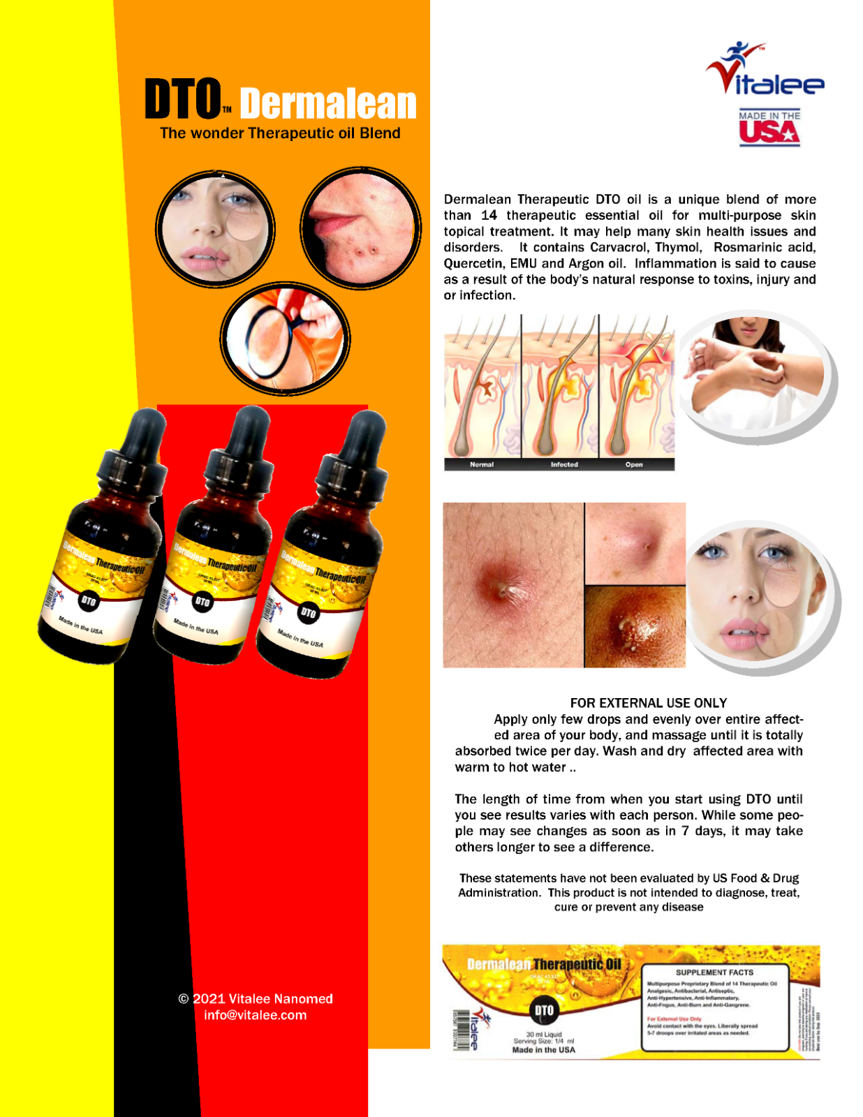 Dermalean DTO-Multi-purpose Boil, Acne, Itching, and Burn Oil (1 Bottle, 30 ml)