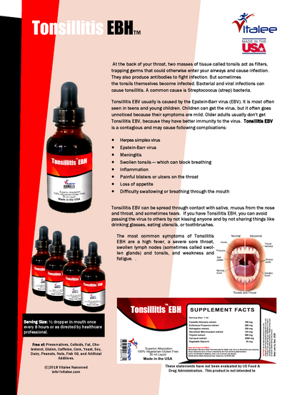 Tonsillitis EBV-Rapid Relief