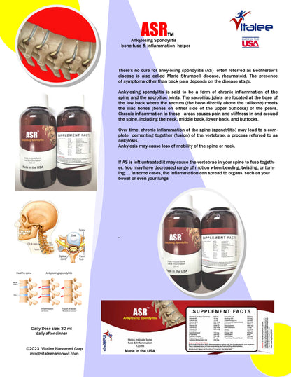 ASR- Ankylosing Spondylitis- Neck Rheumatoid Arthritis
