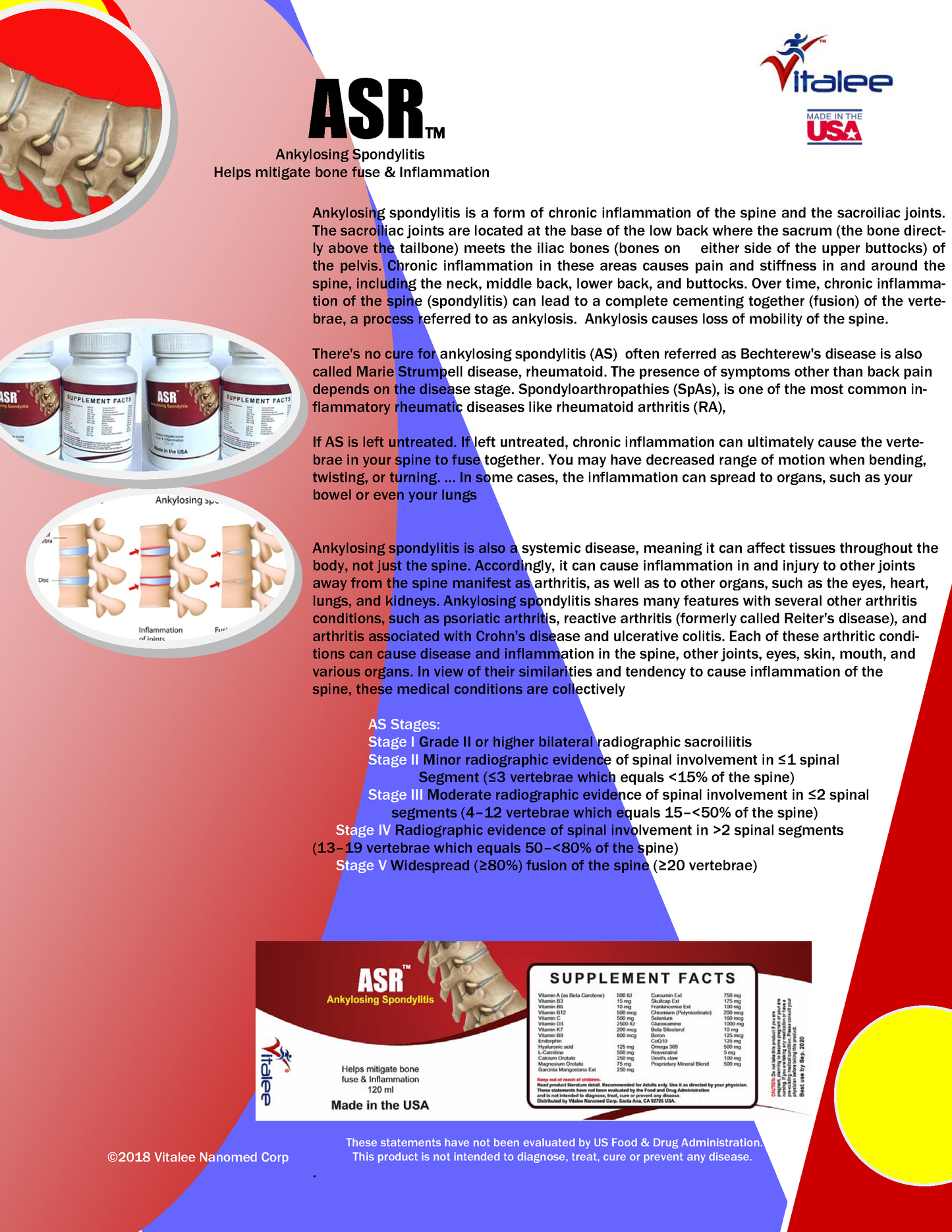 1142-ASR- Ankylosing Spondylitis-Rheumatoid Arthritis Pack  (3X60)Capsule