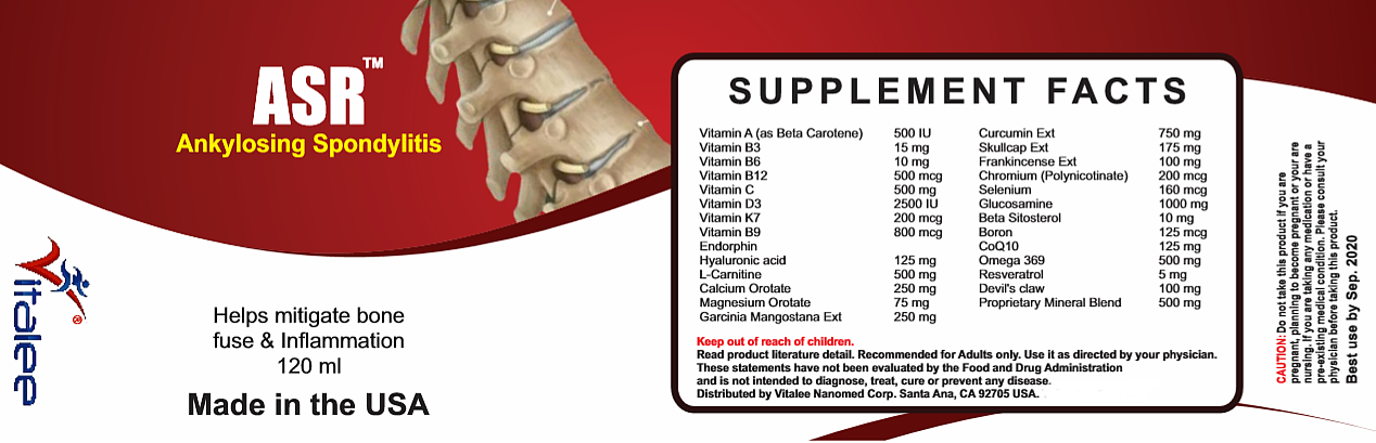 1142-ASR- Ankylosing Spondylitis-Rheumatoid Arthritis Pack  (3X60)Capsule
