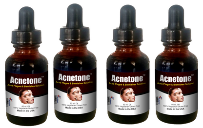 Acnetone-Vitalee Anti Acne inflammation & Blemish Non-Sticky Oil (30/60 ml )