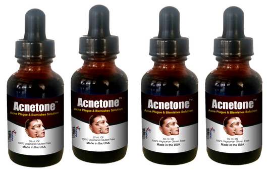 Acnetone-Vitalee Anti Acne inflammation & Blemish Non-Sticky Oil (30/60 ml )