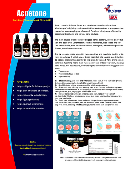 Acnetone-Vitalee Anti Acne inflammation & Blemish Non-Sticky Oil (30/60 ml )