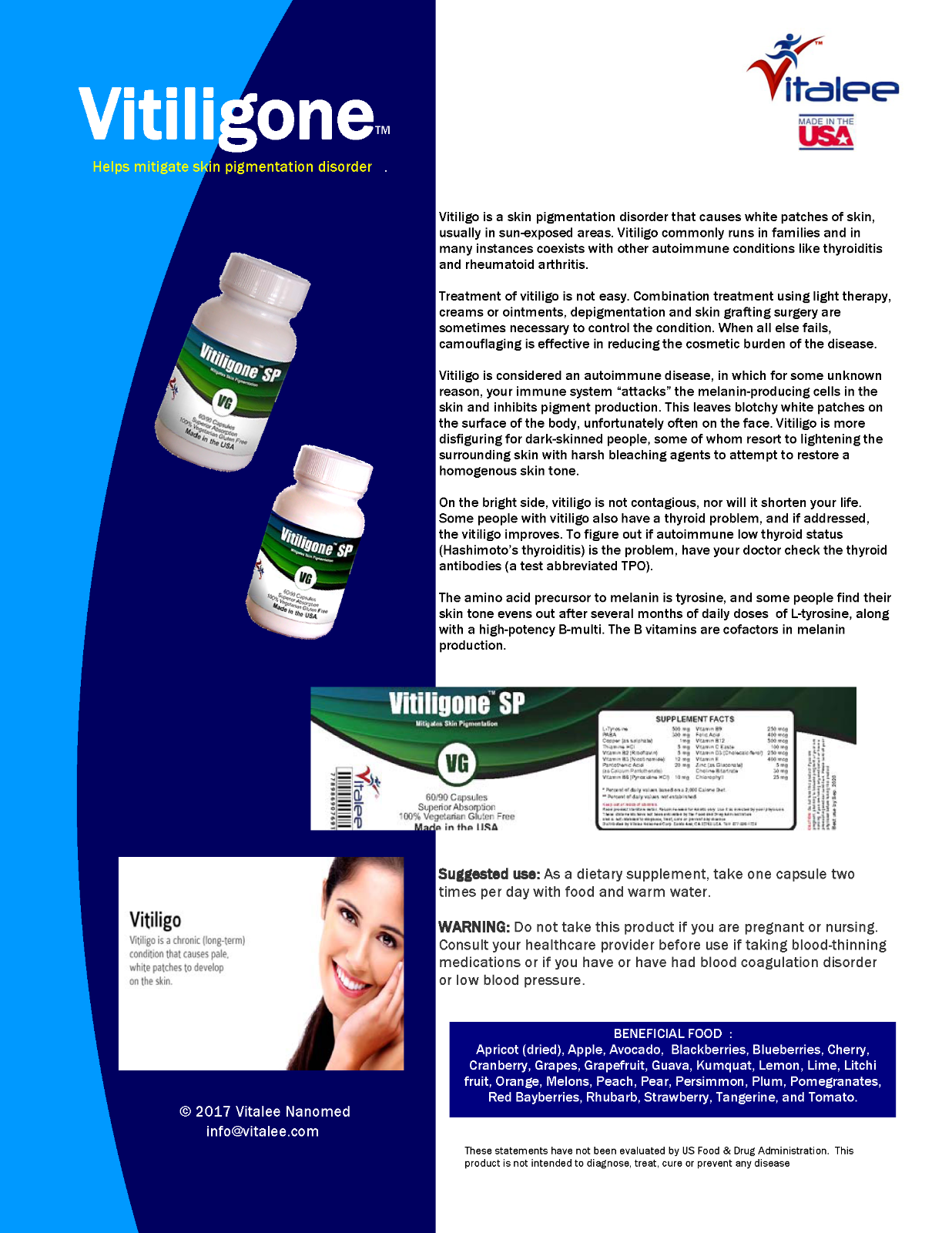 Vitiligone SP. Vitiligone is a Skin Pigmentation Disorder. (Capsule 60ct)