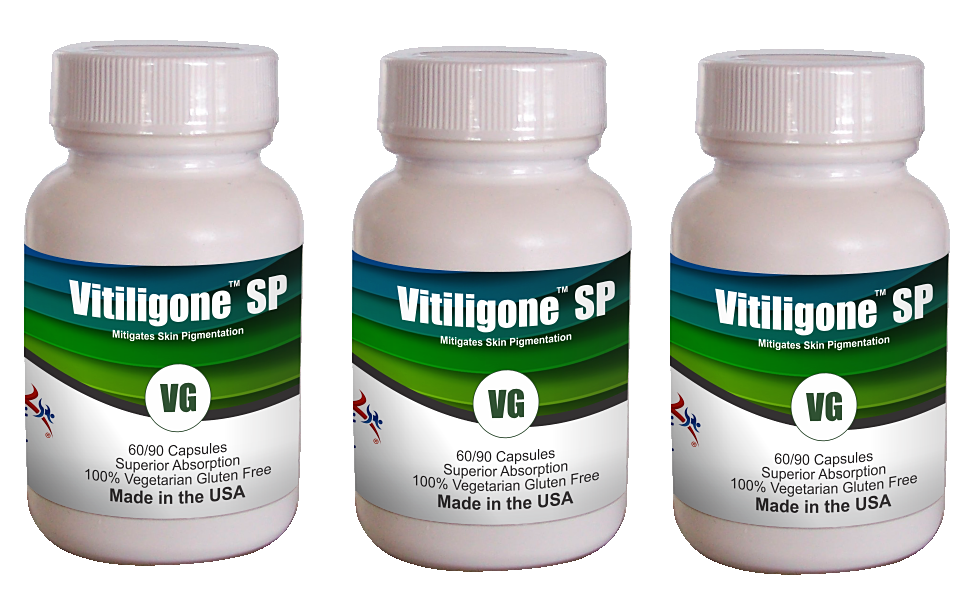 Vitiligone SP. Vitiligone is a Skin Pigmentation Disorder. (Capsule 60ct)