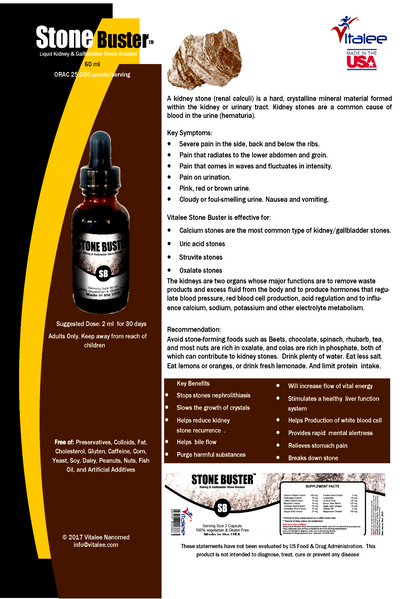 Stone Buster-Kidney/Gallbladder Pain (1 bottle 60 ml)